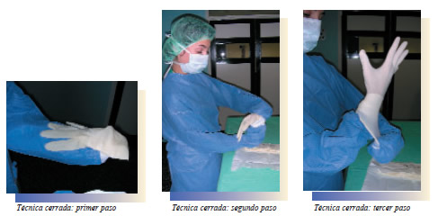 Guantes quirófano: colocación guantes Guantes quirófano: colocación guantes