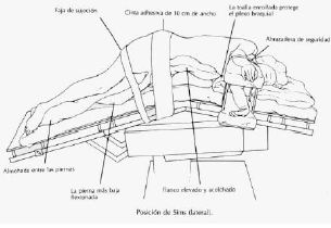 Posiciones en quirófano