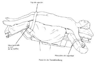 Posiciones en quirófano