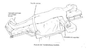Posiciones en quirófano