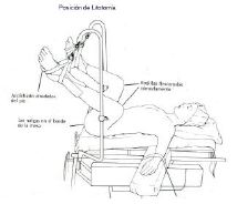 Posiciones en quirófano
