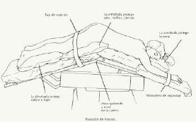 Posiciones en quirófano