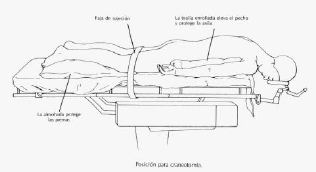 Posiciones en quirófano