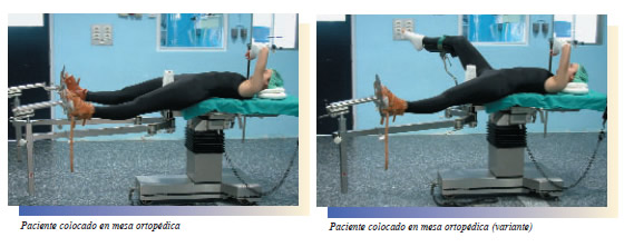 Posiciones en quirófano