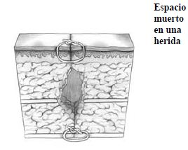 Suturas Suturas