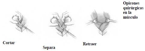 Suturas