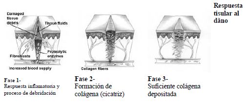 Suturas Suturas