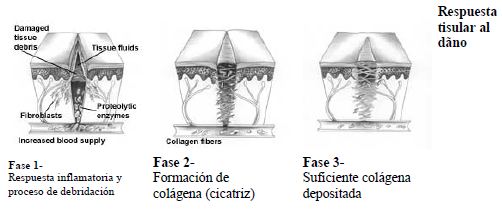 Suturas