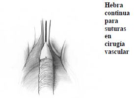 Suturas Suturas