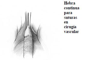 Suturas