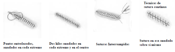Suturas Suturas