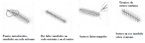 Suturas