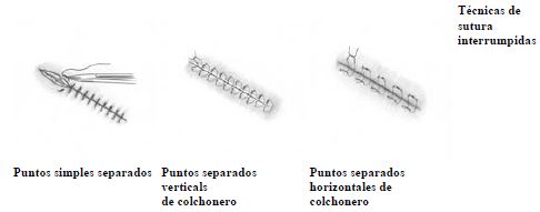 Suturas Suturas